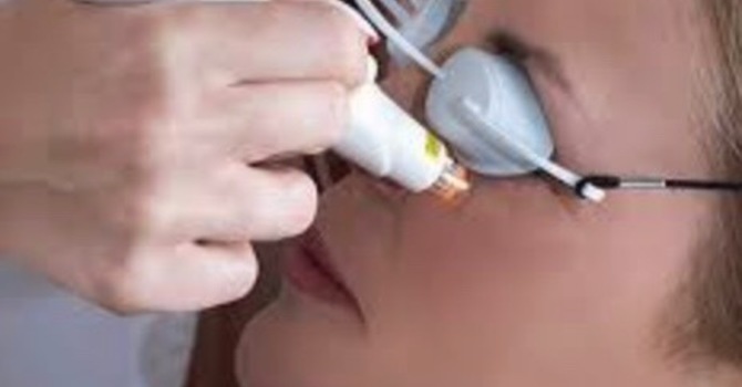 IPL Treatment