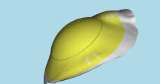 Impression Based Scleral Lenses