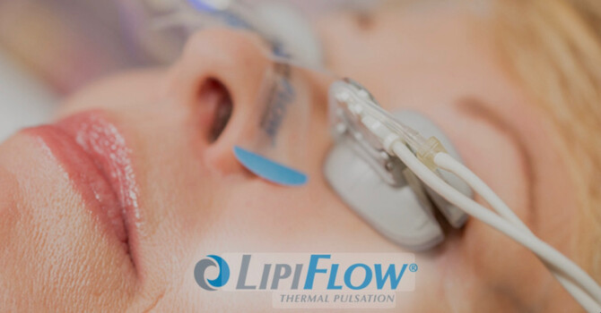 Lipiflow Treatment